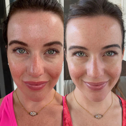 RedGlow | LED Licht Therapie Maske